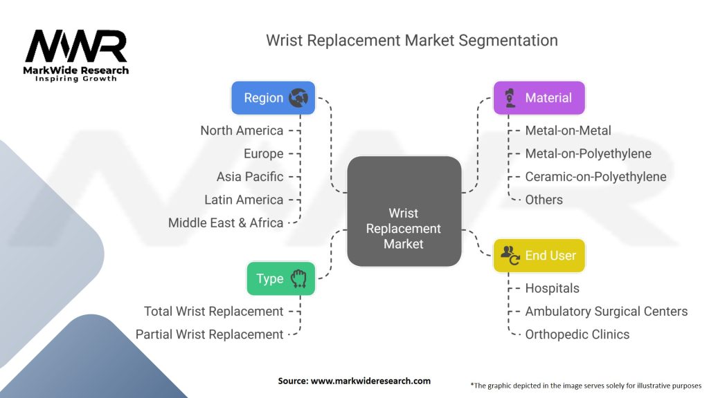 Wrist Replacement Market Segmentation