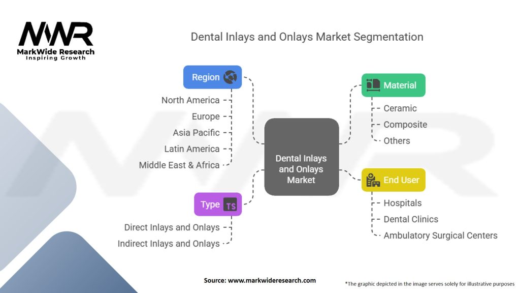 Dental Inlays and Onlays Market Segmentation