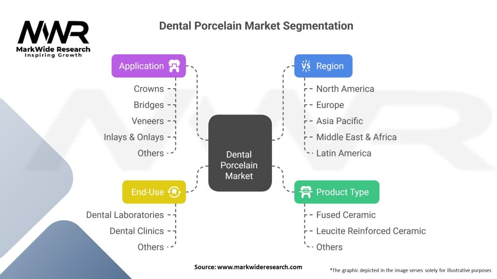 Dental Porcelain Market Segmentation