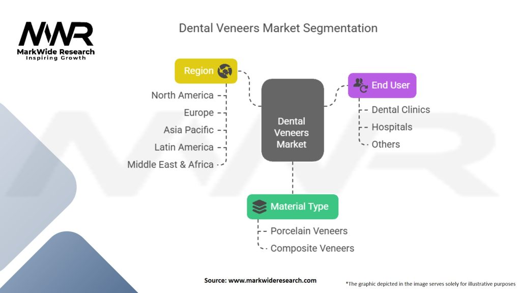 Dental Veneers Market