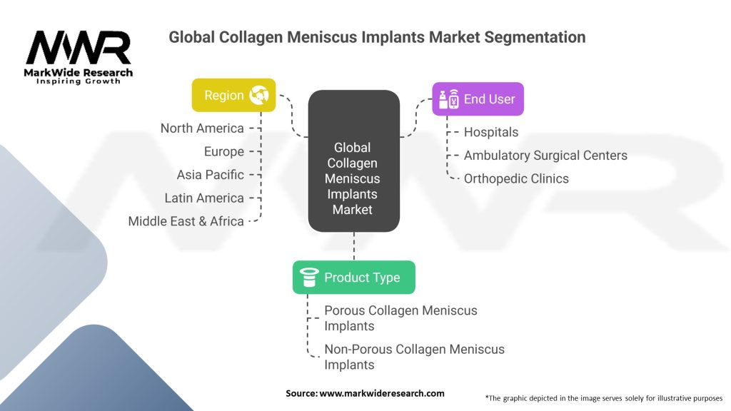 Global Collagen Meniscus Implants Market Segmentation