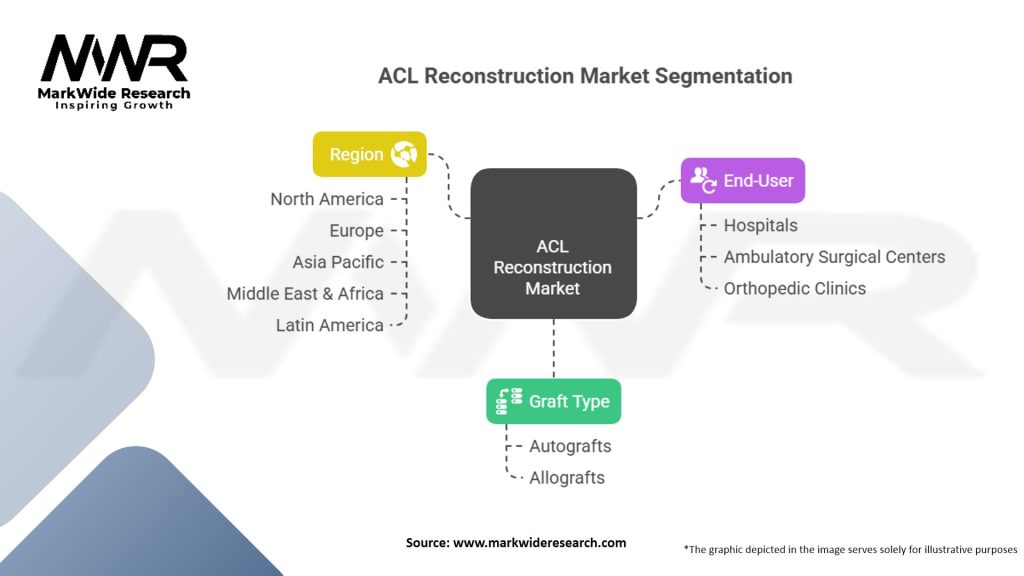 ACL Reconstruction Market Segmentation