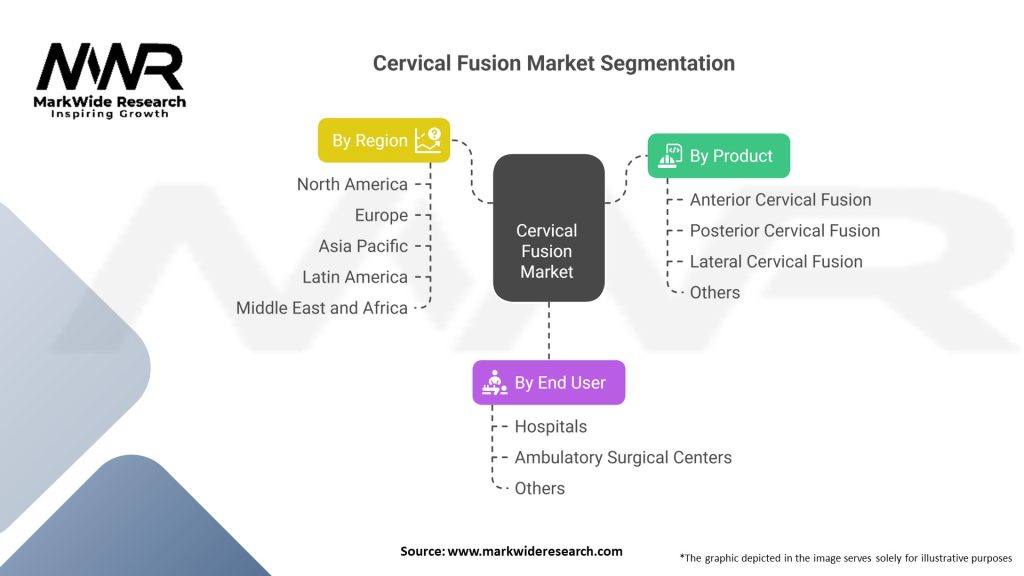 Cervical Fusion market Segmentation