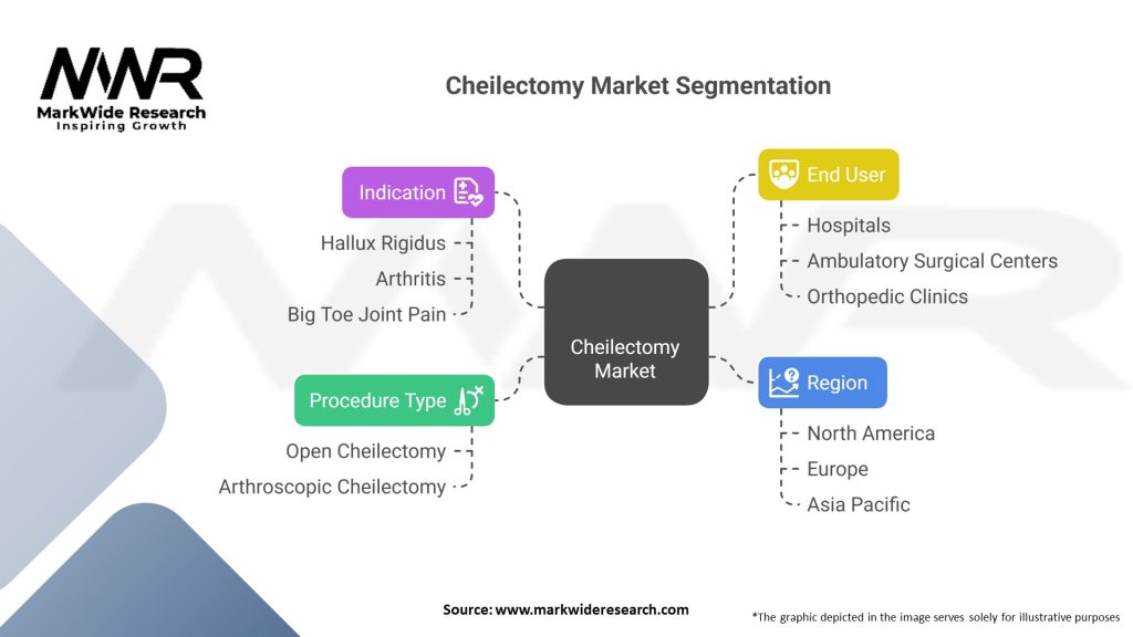 Cheilectomy market Segmentation