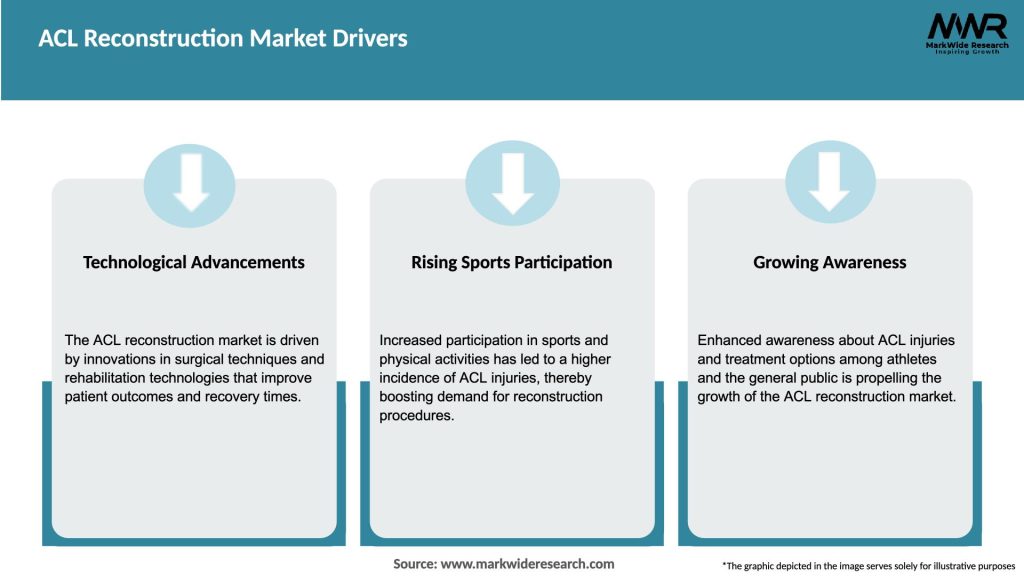 ACL Reconstruction Market Drivers